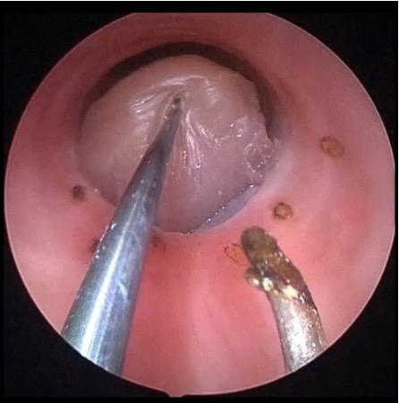 Autonomous surgical robotics